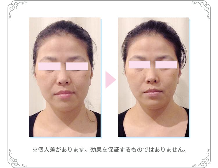 お試し効果3※個人差があります。効果を保証するものではありません